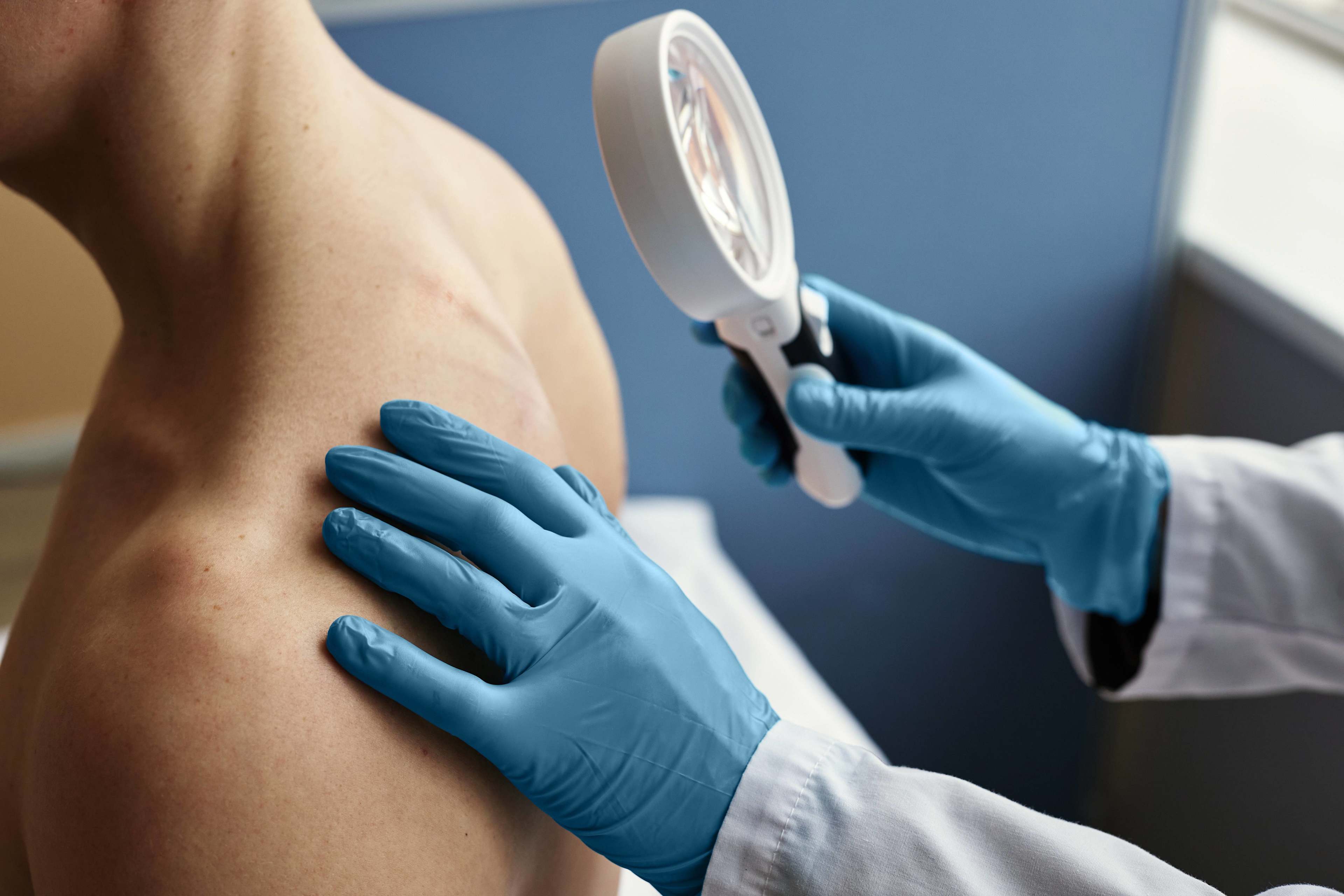 Gesundheit_Dermatologie_Mann_Check_s_dr4lj8