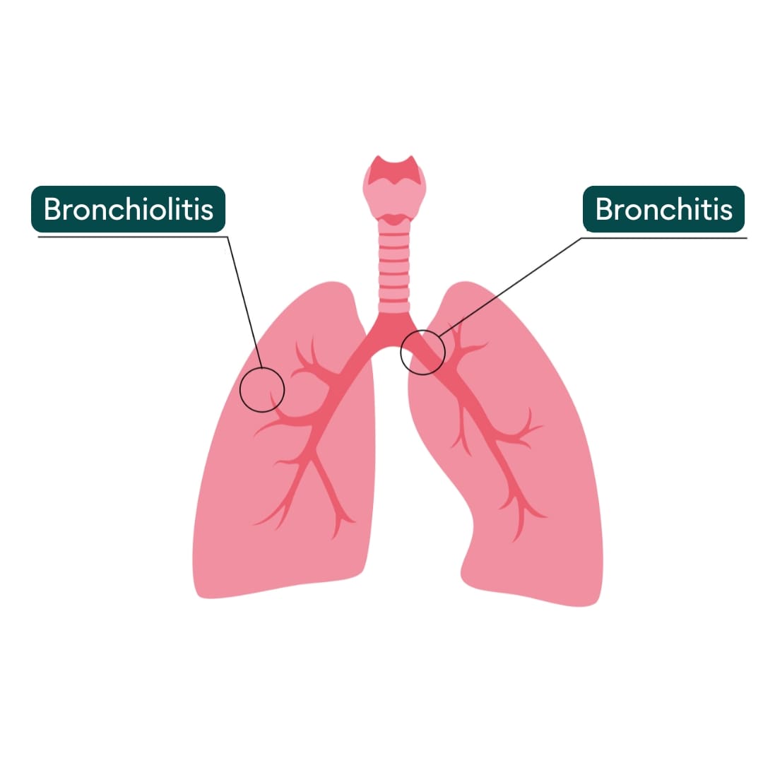 2025-12-23-gesundheitstipp-rsv-lunge-inhaltsbild-1080x1080-DE